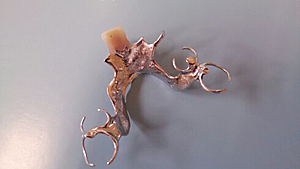 Croydon Dental Laboratory 